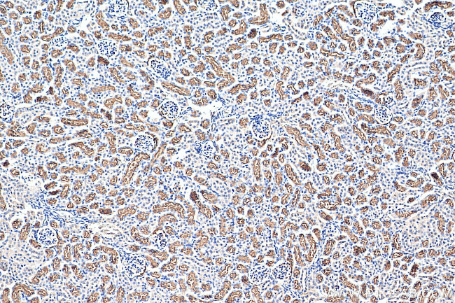 TAOK3 Antibody in Immunohistochemistry (Paraffin) (IHC (P))