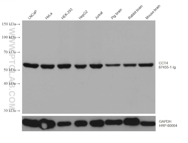 CCT4 Antibody in Western Blot (WB)