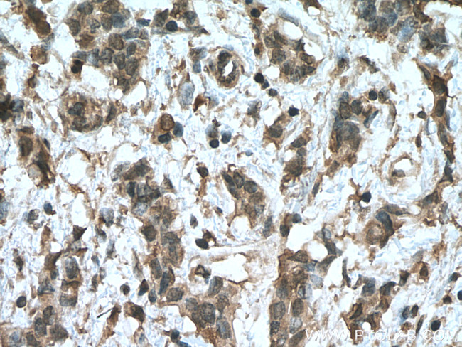 HMBS Antibody in Immunohistochemistry (Paraffin) (IHC (P))