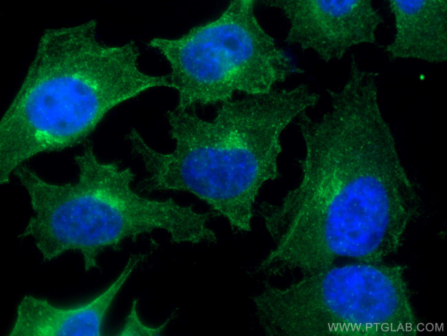 CEP55 Antibody in Immunocytochemistry (ICC/IF)