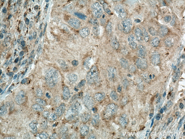 MGME1 Antibody in Immunohistochemistry (Paraffin) (IHC (P))