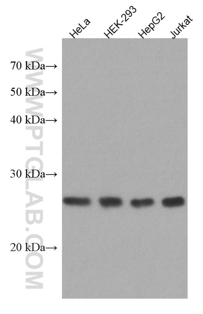 MIS12 Antibody in Western Blot (WB)