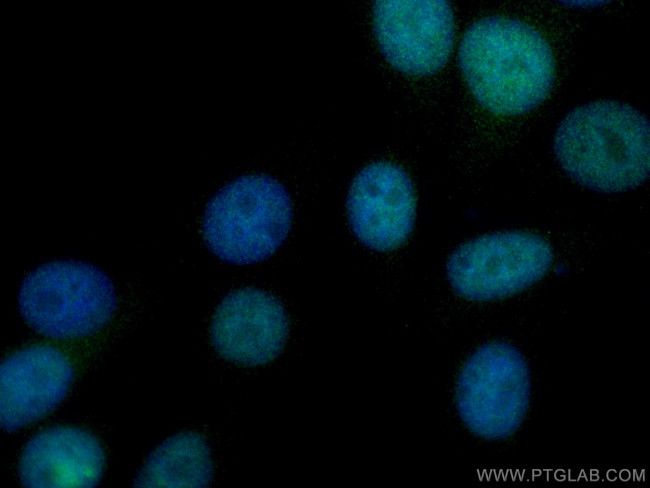 MGMT Antibody in Immunocytochemistry (ICC/IF)