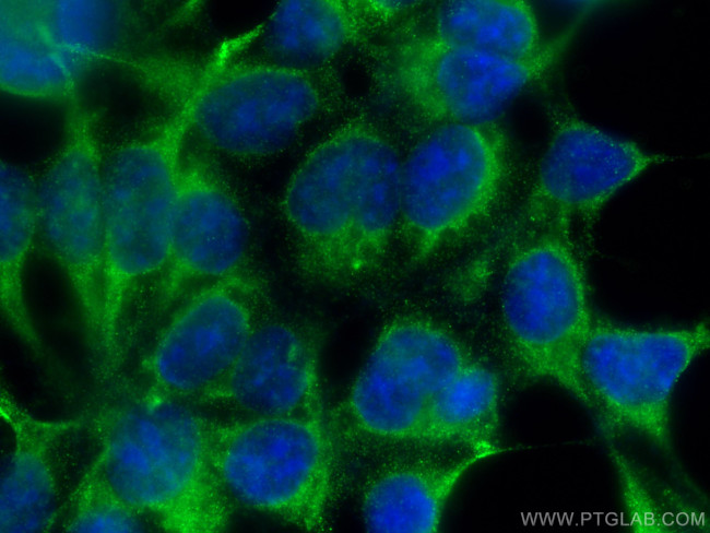 SLC22A7 Antibody in Immunocytochemistry (ICC/IF)