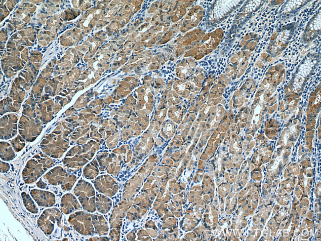 AHCYL2 Antibody in Immunohistochemistry (Paraffin) (IHC (P))