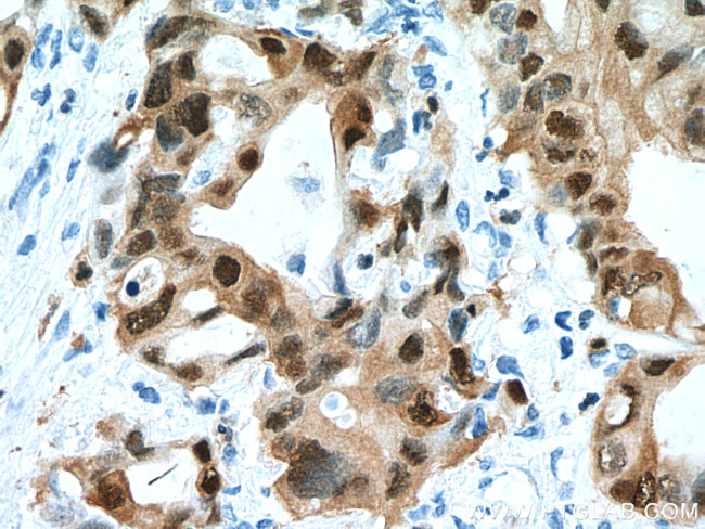 S100P Antibody in Immunohistochemistry (Paraffin) (IHC (P))