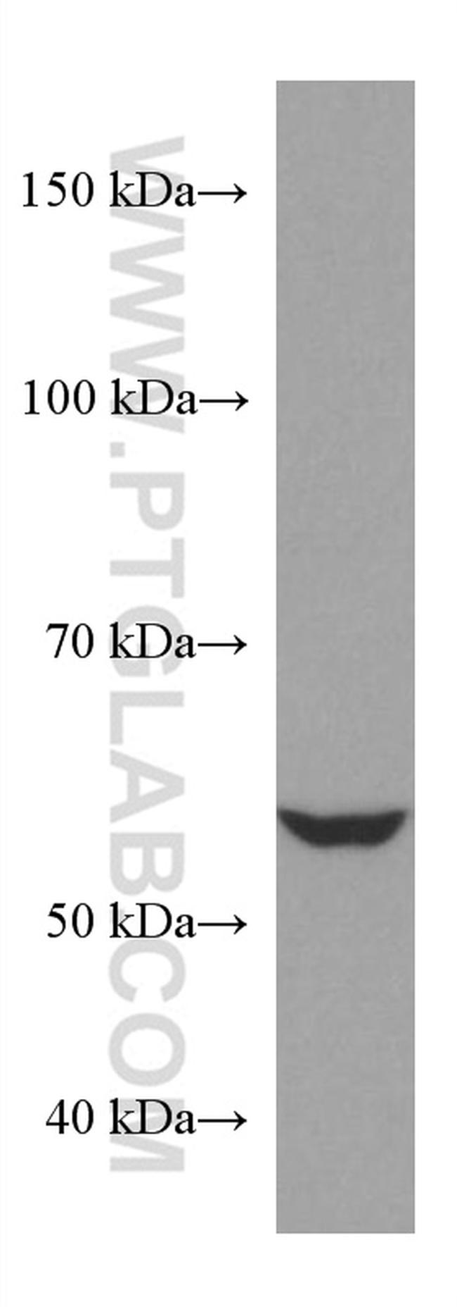 NR2C2 Antibody in Western Blot (WB)