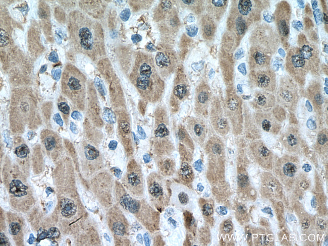 UNG Antibody in Immunohistochemistry (Paraffin) (IHC (P))