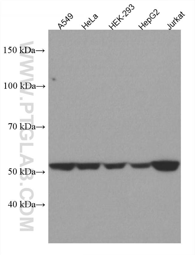 TRIM5 Antibody in Western Blot (WB)
