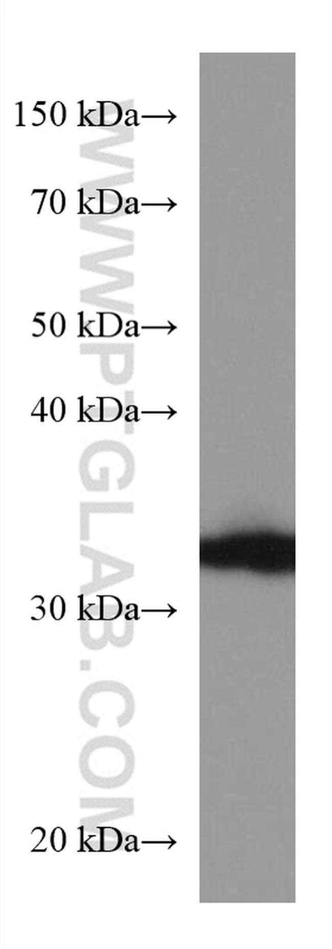 AKR1B1 Antibody in Western Blot (WB)