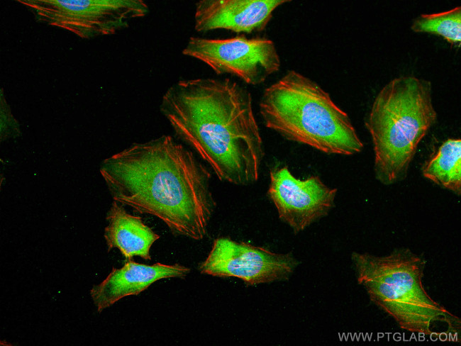 PRDX6 Antibody in Immunocytochemistry (ICC/IF)