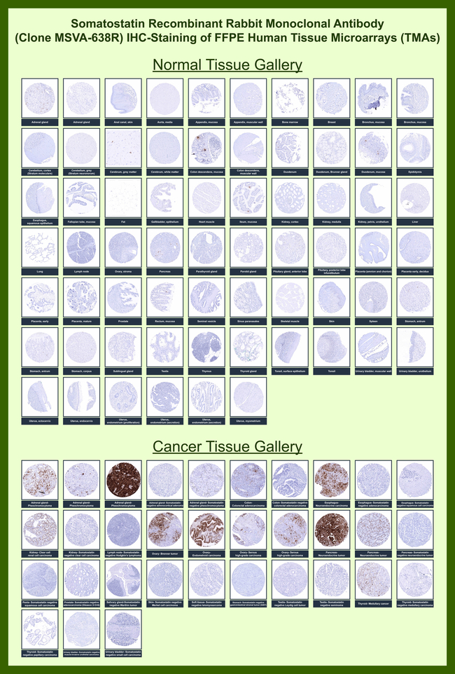 Somatostatin (SST) Antibody in Immunohistochemistry (Paraffin) (IHC (P))