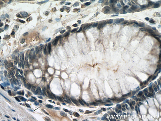 RAN Antibody in Immunohistochemistry (Paraffin) (IHC (P))