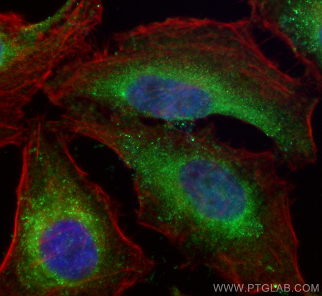 RHOBTB3 Antibody in Immunocytochemistry (ICC/IF)