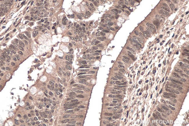 RBM15B Antibody in Immunohistochemistry (Paraffin) (IHC (P))