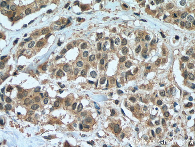 ZEB2 Antibody in Immunohistochemistry (Paraffin) (IHC (P))