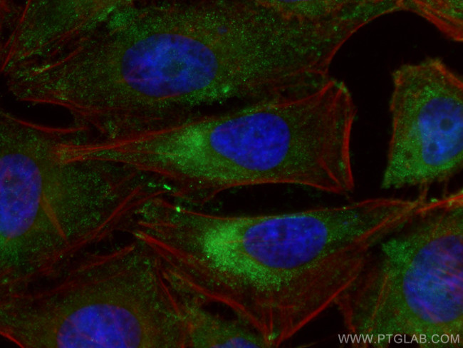 HPRT1 Antibody in Immunocytochemistry (ICC/IF)
