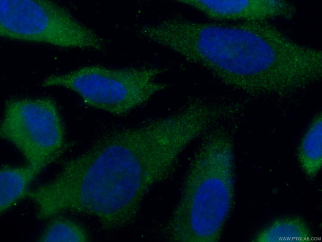 CMPK1 Antibody in Immunocytochemistry (ICC/IF)
