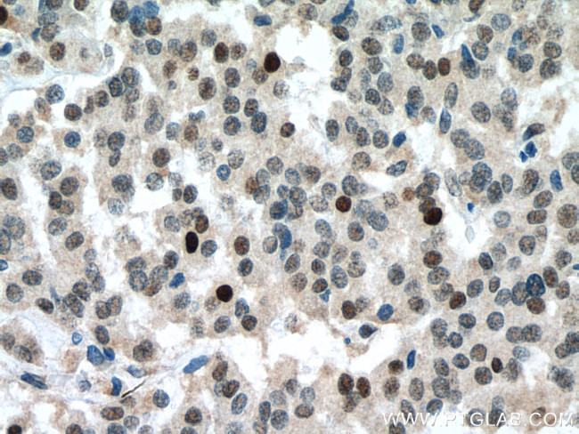RB1 Antibody in Immunohistochemistry (Paraffin) (IHC (P))