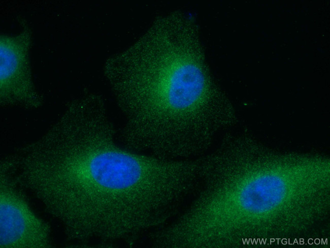 FES Antibody in Immunocytochemistry (ICC/IF)