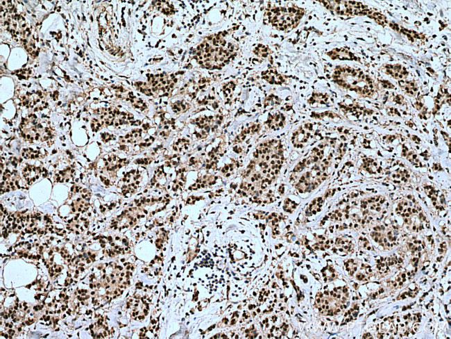 IPO7 Antibody in Immunohistochemistry (Paraffin) (IHC (P))