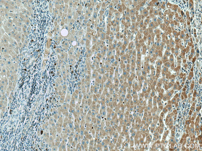 AMT Antibody in Immunohistochemistry (Paraffin) (IHC (P))