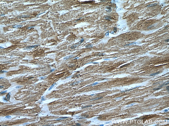 MYL4 Antibody in Immunohistochemistry (Paraffin) (IHC (P))