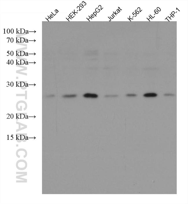 RAB8A Antibody in Western Blot (WB)