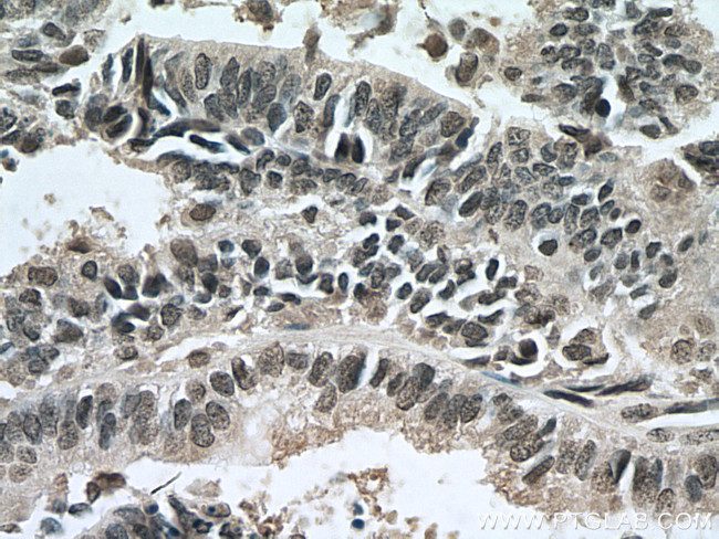 RBM8A/Y14 Antibody in Immunohistochemistry (Paraffin) (IHC (P))