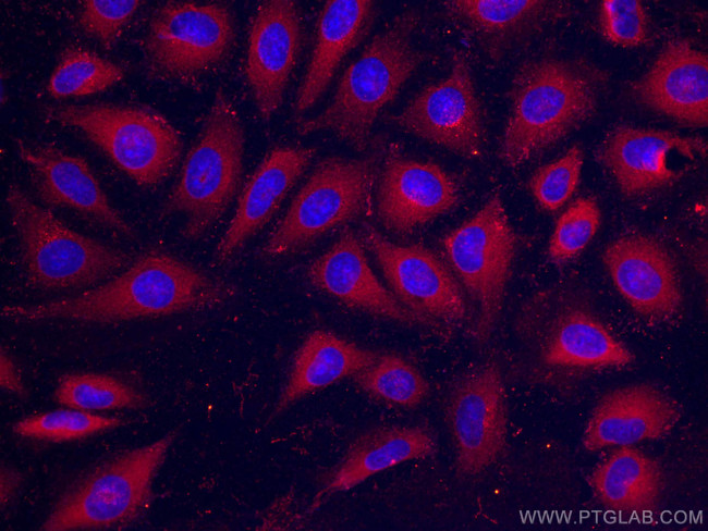 RHOC Antibody in Immunocytochemistry (ICC/IF)
