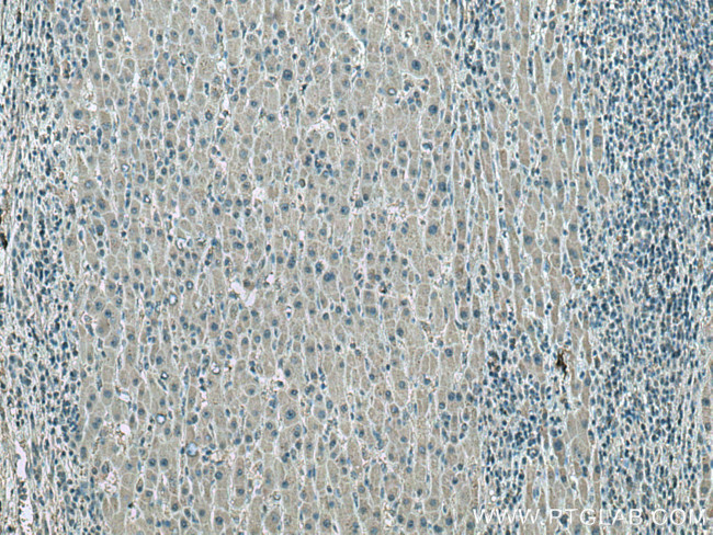 ATP1B3 Antibody in Immunohistochemistry (Paraffin) (IHC (P))