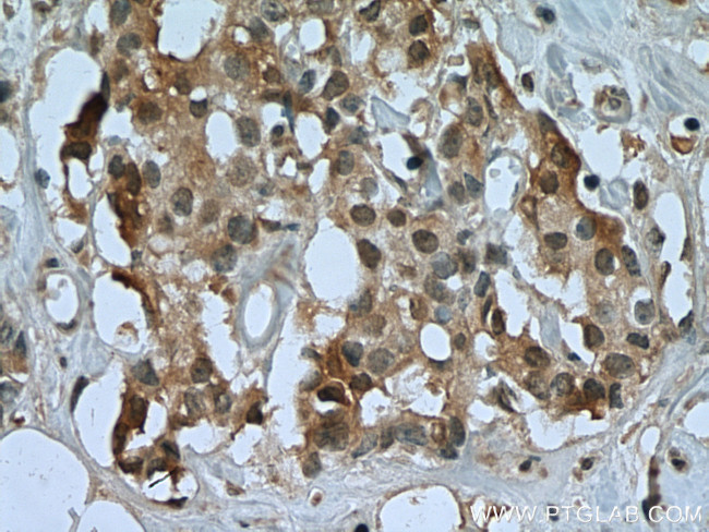 USP15 Antibody in Immunohistochemistry (Paraffin) (IHC (P))