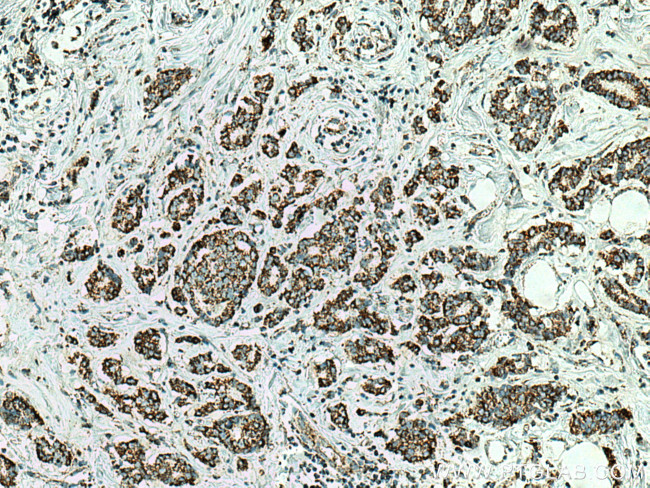 GRP75 Antibody in Immunohistochemistry (Paraffin) (IHC (P))