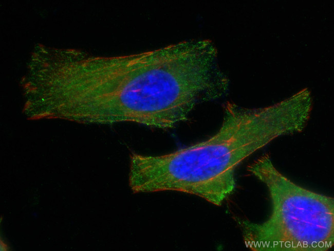 PICALM Antibody in Immunocytochemistry (ICC/IF)