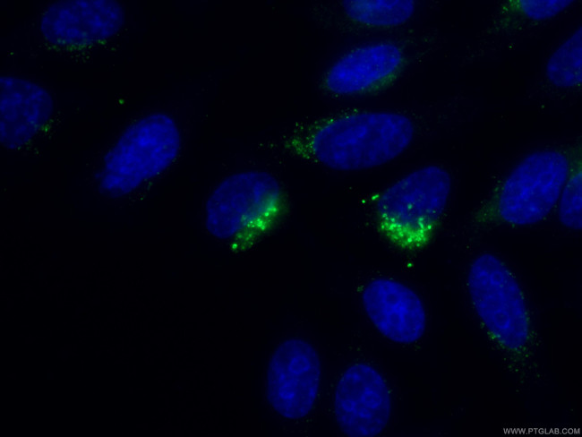 RPS14 Antibody in Immunocytochemistry (ICC/IF)