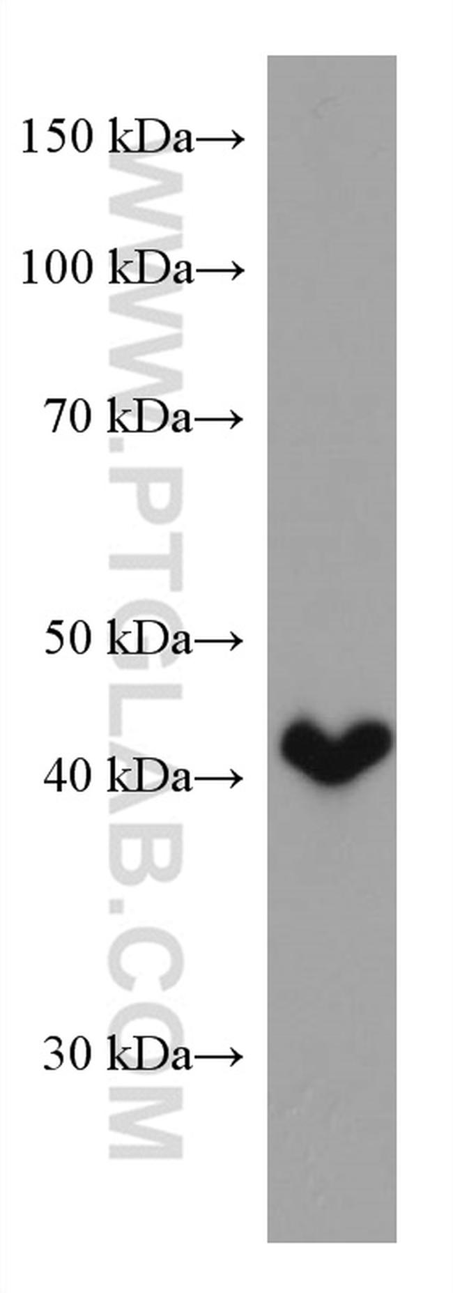 HSD3B2 Antibody in Western Blot (WB)
