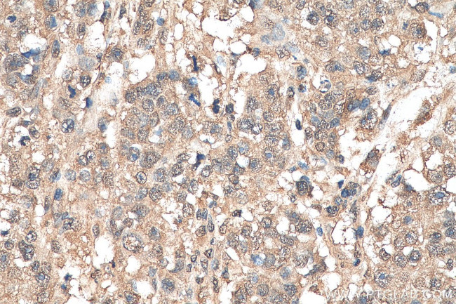 ETV6 Antibody in Immunohistochemistry (Paraffin) (IHC (P))