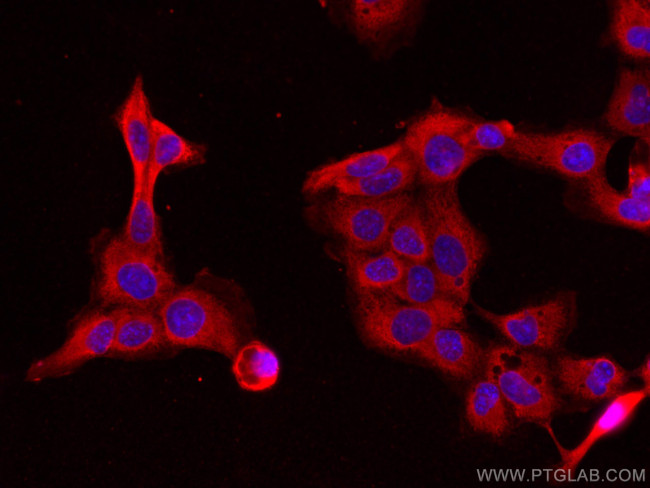 NCF2 Antibody in Immunocytochemistry (ICC/IF)