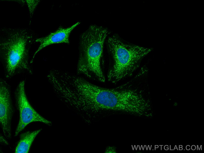 Prx5 Antibody in Immunocytochemistry (ICC/IF)