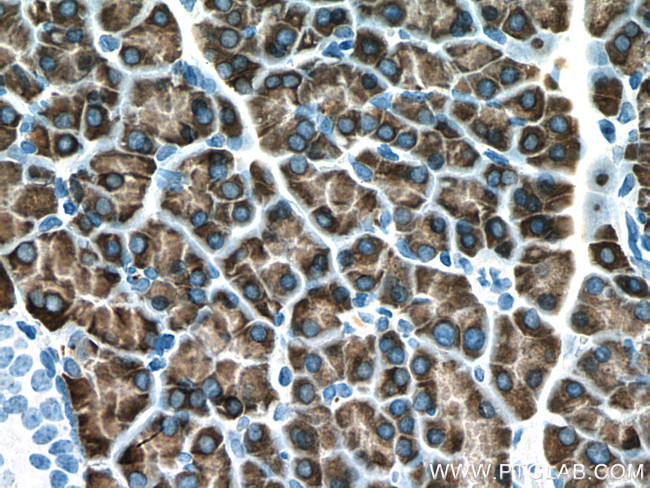 PNLIPRP1 Antibody in Immunohistochemistry (Paraffin) (IHC (P))