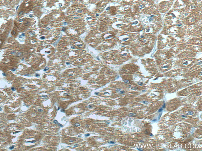 MYBPC3 Antibody in Immunohistochemistry (Paraffin) (IHC (P))