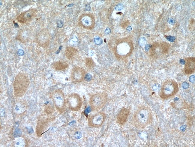 NCS1 Antibody in Immunohistochemistry (Paraffin) (IHC (P))