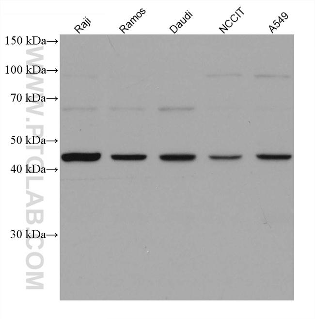 VSX2 Antibody in Western Blot (WB)