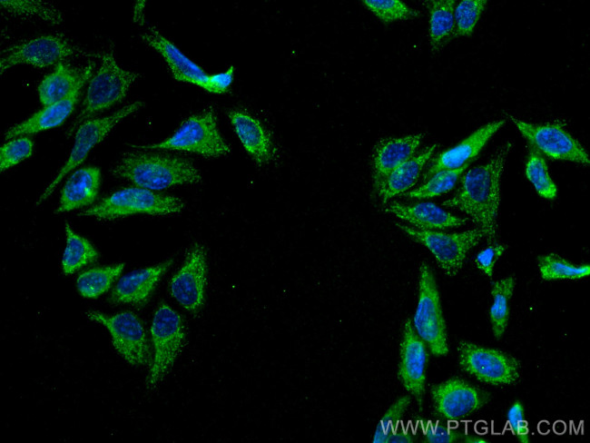 Ch-TOG Antibody in Immunocytochemistry (ICC/IF)
