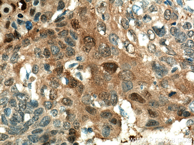 Maspin Antibody in Immunohistochemistry (Paraffin) (IHC (P))