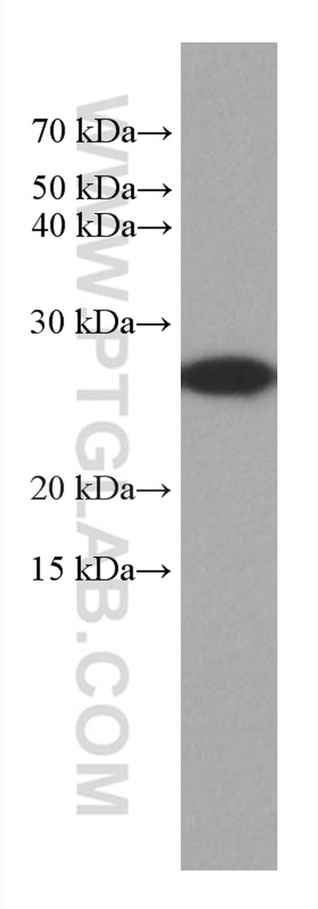 GSTM3 Antibody in Western Blot (WB)