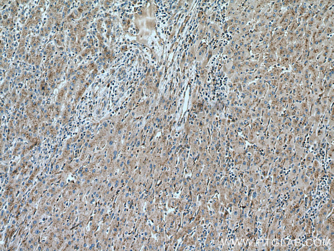 SLC25A17 Antibody in Immunohistochemistry (Paraffin) (IHC (P))