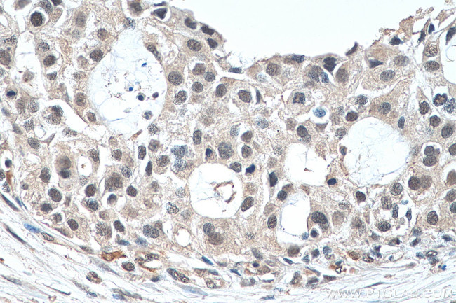 EXOSC9 Antibody in Immunohistochemistry (Paraffin) (IHC (P))