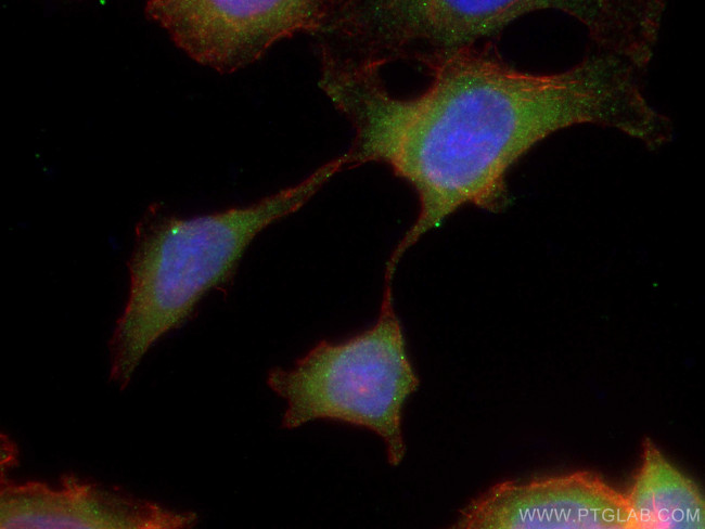 CCDC6 Antibody in Immunocytochemistry (ICC/IF)