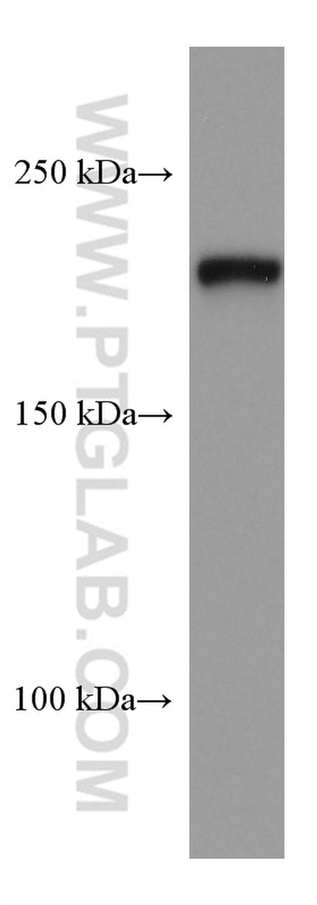 PHLPP Antibody in Western Blot (WB)